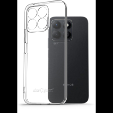 AlzaGuard Crystal Clear Honor X8b TPU tok (AGD-PCT400Z) tok és táska