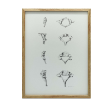 ANATÓMIAI PLAKÁT NYAKI csigolyákhoz ARANY KERET 30x40 CM grafika, keretezett kép