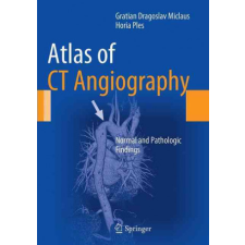  Atlas of CT Angiography – Gratian Dragoslav Miclaus,Horia Ples idegen nyelvű könyv