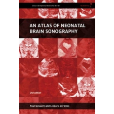 Atlas of Neonatal Brain Sonography – Paul Govaert,Linda S. de Vries idegen nyelvű könyv