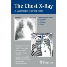  Chest X-Ray – Matthias Hofer idegen nyelvű könyv