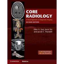  Core Radiology – Junzi Shi,Jacob C. Mandell idegen nyelvű könyv
