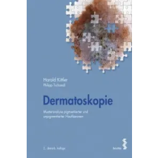  Dermatoskopie – Harald Kittler idegen nyelvű könyv