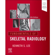 Elsevier Health Sciences Helms - Fundamentals of Skeletal Ra | Kenneth S. Lee egyéb könyv
