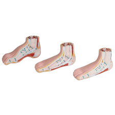  Erler Zimmer Lábfej modellek - általános és abnormális lábfej gyógyászati segédeszköz