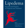 Hammersmith Health Books Lipedema | Leslyn Keith,Stanley G Rockson