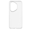 Honor choice honor400 Pro Case White (5504ADLK)