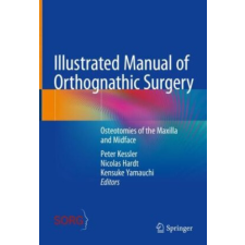 Illustrated Manual of Orthognathic Surgery – Peter Kessler,Nicolas Hardt,Kensuke Yamauchi idegen nyelvű könyv