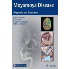 Moyamoya Disease – John E. Wanebo,Joseph M. Zabramski,Robert F. Spetzler idegen nyelvű könyv