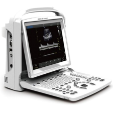  Orvosi diagnosztikus ultrahang CHISON ECO3 EXP. B&amp;W + PW gyógyhatású készítmény