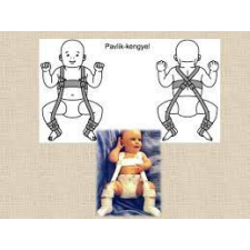  Pavlik kengyel gyógyászati segédeszköz