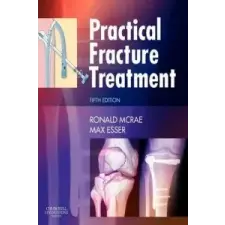  Practical Fracture Treatment – Ronald McRae idegen nyelvű könyv