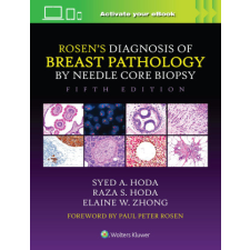  Rosen's Diagnosis of Breast Pathology by Needle Core Biopsy – Syed A. Hoda,Raza S. Hoda,Elaine Zhong idegen nyelvű könyv