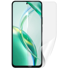  Screenshield HUAWEI Honor 200 Smart védőfólia (HUA-HON200SMT-D) mobiltelefon kellék