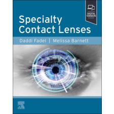  Specialty Contact Lenses – Daddi Fadel,Melissa Barnett idegen nyelvű könyv