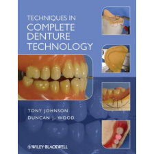  Techniques in Complete Denture Technology – Tony Johnson idegen nyelvű könyv