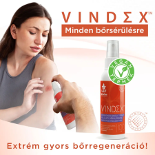 Wise Tree Naturals  (WTN) Vindex bőrkondicionáló spray 100ml WTN vitamin és táplálékkiegészítő